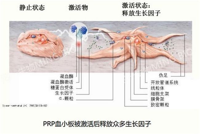 蕪湖市中醫(yī)醫(yī)院首次開(kāi)展PRP治療難治性外傷(圖5)