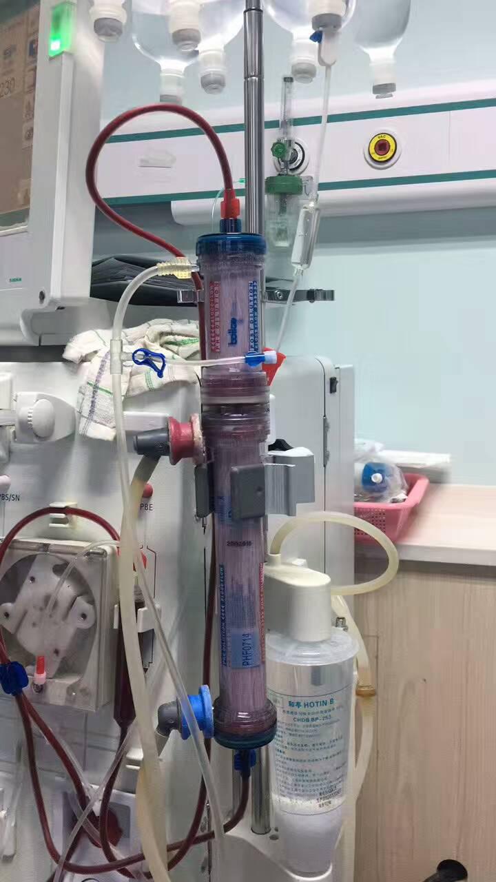 我院血透中心完成安徽省首例尿毒癥患者雙腔血液透析濾過（PHF）術(圖2)